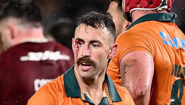 Epa12278973 Nic White Of Australia Looks On After Sustaining A Cut To His Eye During The Third Test Match Between The Wallabies And The British And Irish Lions At Accor Stadium In Sydney, Australia, 02 August 2025.  Epa/Dan Himbrechts  Australia And New Zealand Out