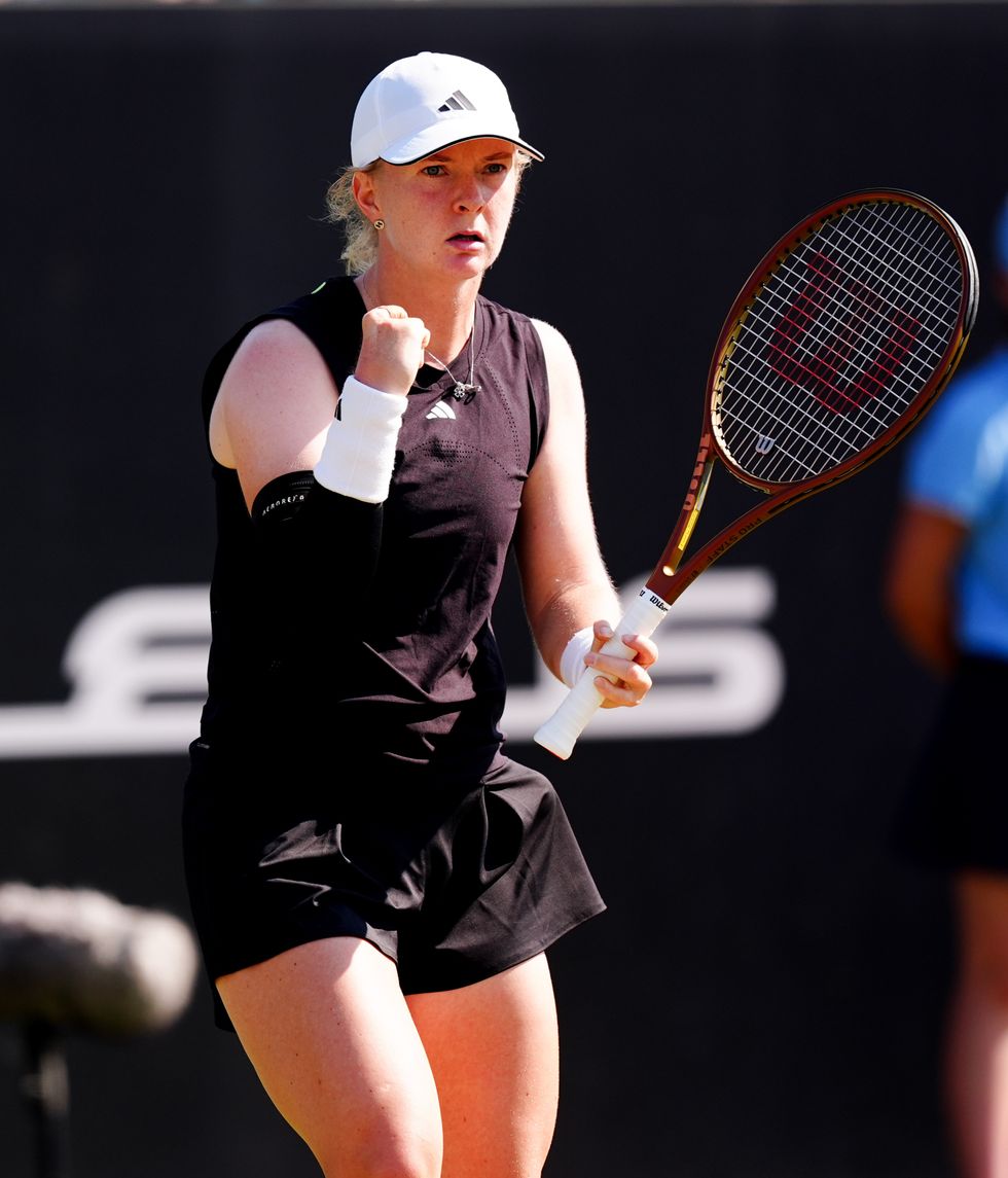 Francesca Jones Was Born With Ectrodactyly Ectodermal Dysplasia