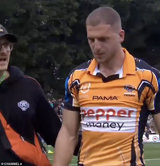 The Tigers Half-Back Is Suspetcted To Have Suffered A Fractured Cheekbone And Was Taken To Hospital After Being Walked From The Field