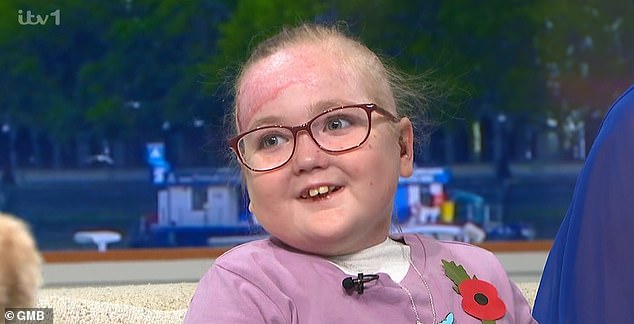 13-Year-Old Jasmine Lives With The Horrific Condition Which Causes Her Skin To Itch And Blister At The Slightest Inconvenience