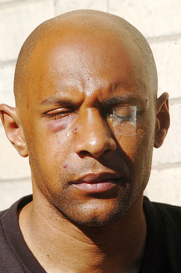 Barton’s Manchester City Team-Mate Ousmane Dabo Was 30 When He Left Him Unconscious, With A Detached Retina, At The Training Ground