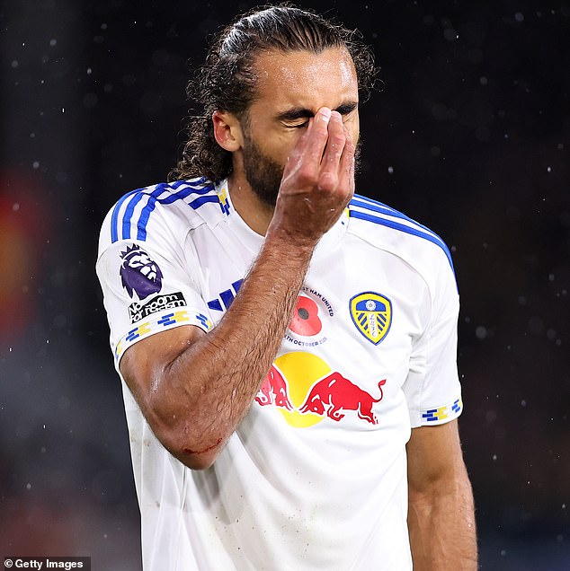 Dominic Calvert-Lewin Signed On A Free Following His Release By Everton But Has Only Scored One Goal This Season