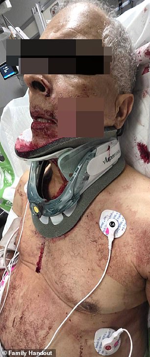 The Trucker Was Cut During An Altercation With Ex-Nfl Star Mark Sanchez In Indianapolis Early Saturday Morning, Suffering A Laceration That Went Through His Cheek And Hit His Tongue