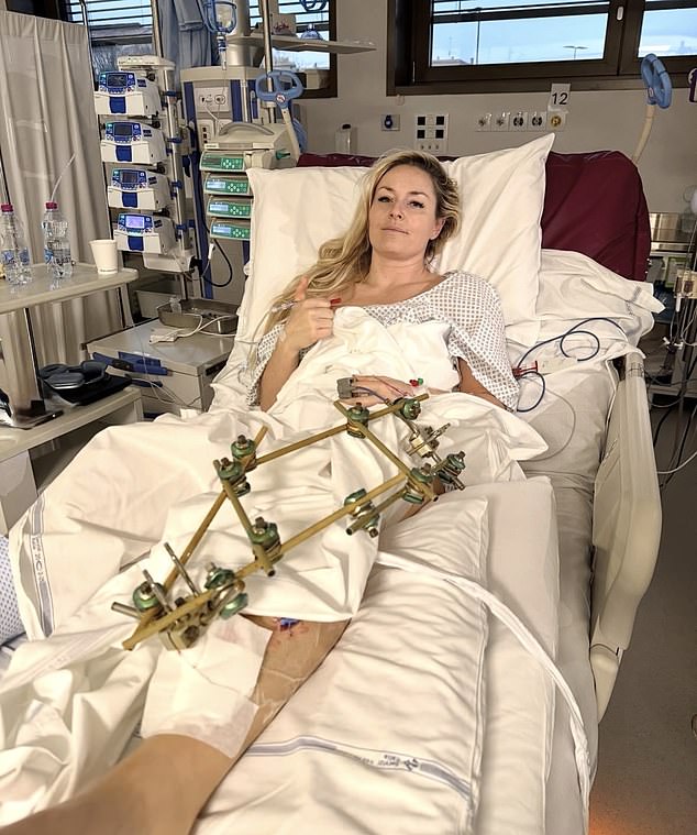 Vonn Has Shared An Update From Hospital After Breaking Her Leg At The Winter Olympics