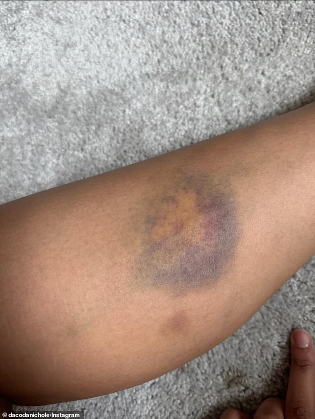 The Post Included Pictures Of Bruises And Scratches, As Well As Damage To Her Property