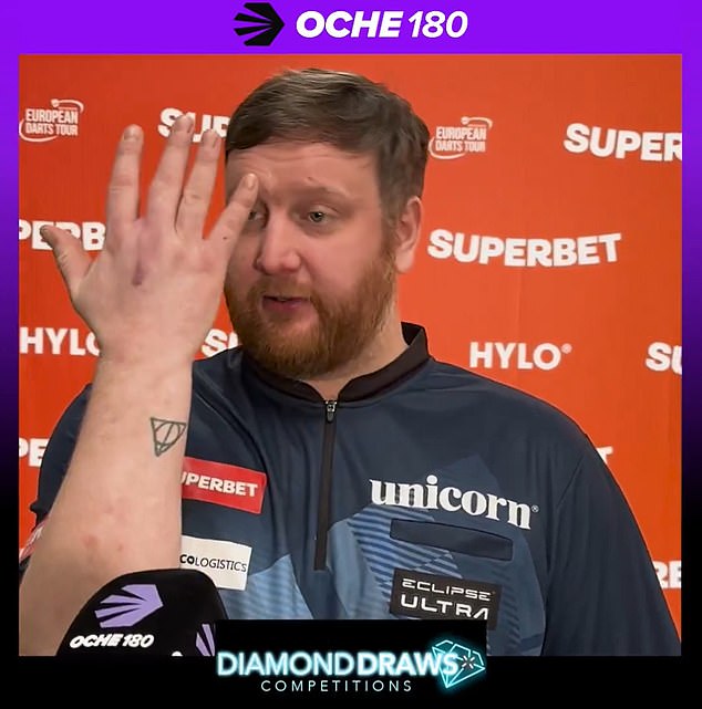 Cameron Menzies Showed The Extent Of His Scarring After Badly Injuring His Hand Last Year