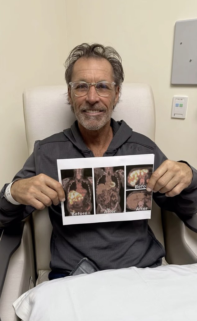 Former New York Rangers Star Ron Duguay Is In A Battle With Stage 4 Cancer