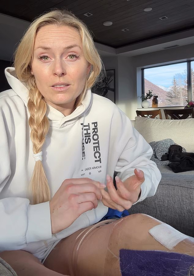 Lindsey Vonn Is Out Of Hospital But Is Only At The Start Of Her Recovery From A Broken Leg