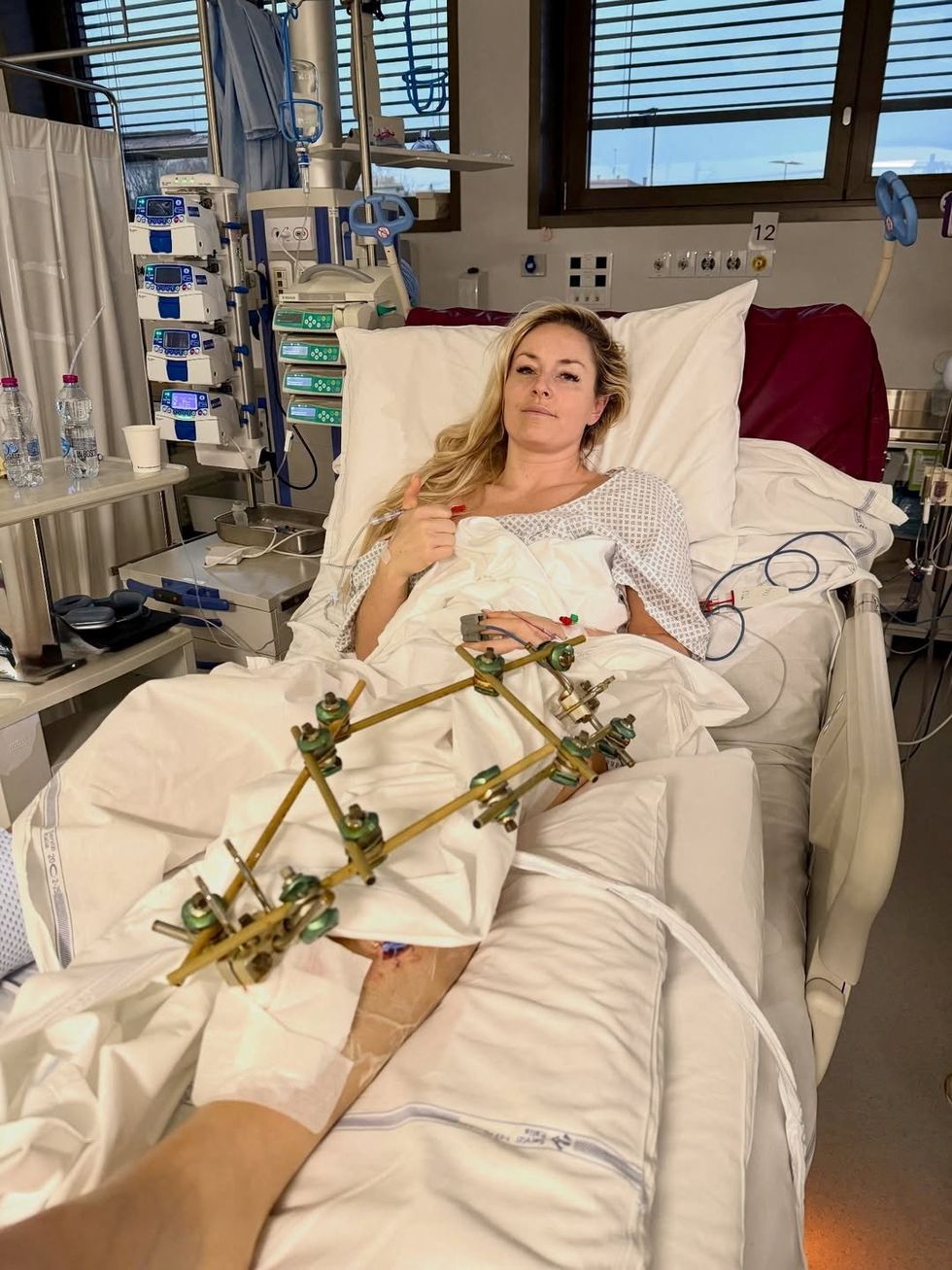 Lindsey Vonn Has Arrived Back In The United States Following A Harrowing Week Of Medical Treatment In Italy After Her Devastating Crash At The Winter Olympics