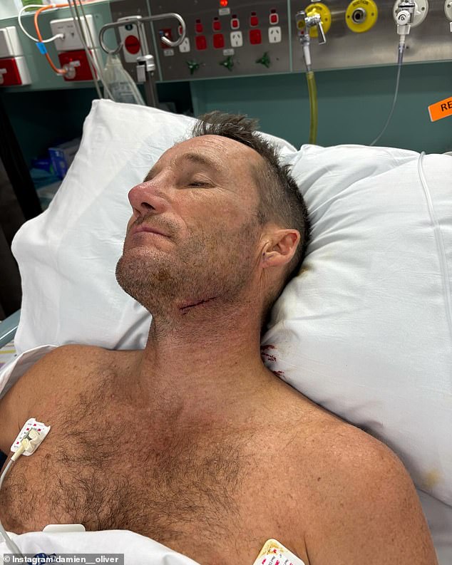 Racing Legend Damien Oliver Shared This Image From Hospital After Suffering A Surfing Accident