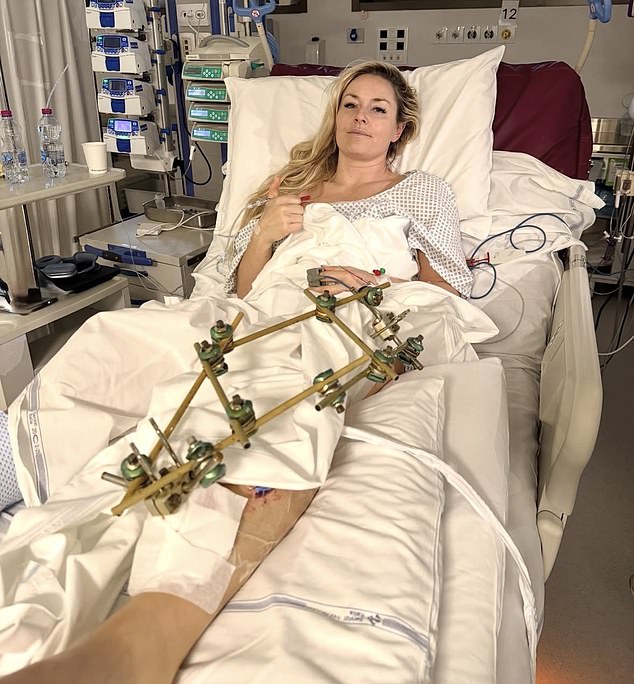A Top Surgeon Revealed How Close Lindsey Vonn Was To Losing Her Leg At The Winter Games